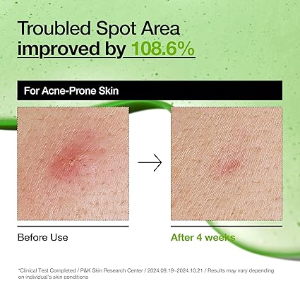 Anua 10+ Azelaic Acid 10+ Hyaluron Redness Soothing Serum