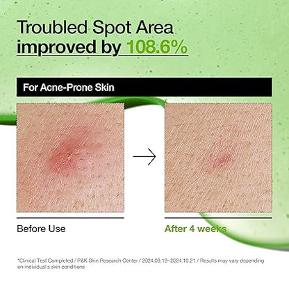 Anua 10+ Azelaic Acid 10+ Hyaluron Redness Soothing Serum